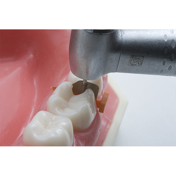 FenderWedge kiler, Large, Gul, 36 stk.