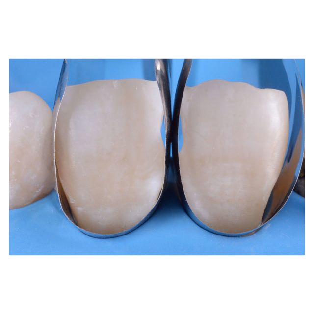 Polydentia Unica minideep Anterior matricer, 12 stk.