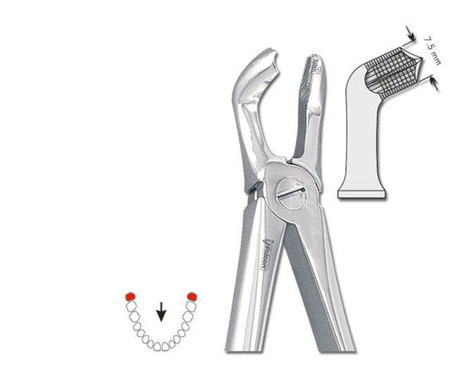 Ekstraktionstang nr. 79, Visdomstand UK